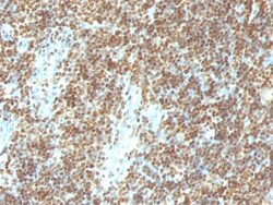 DNA Antibody (DSD/958), Novus Biologicals 0.2mg; Unlabeled:Antibodies,
